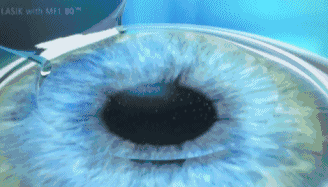 1605491163187632.gif 微信图片_20201116094550.gif